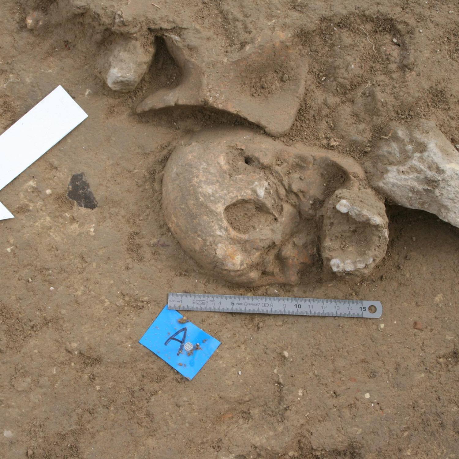 antropología forense 3